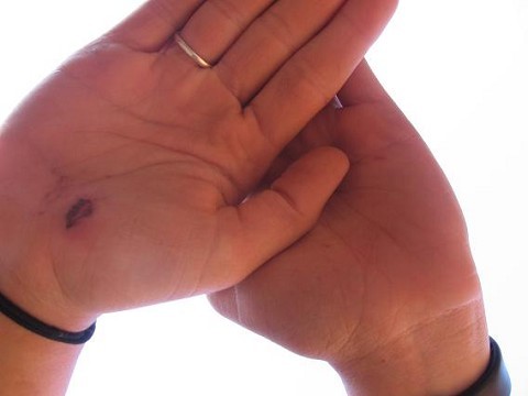 Africa shaped wound in the palm of my hand