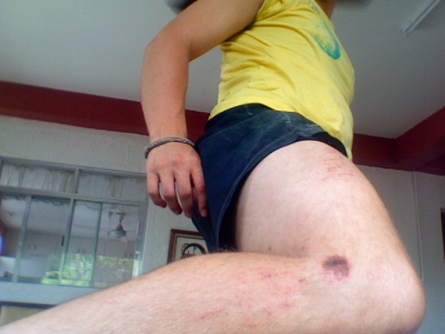 This is actually the outfit I crashed in. Who wears short shorts? I do!